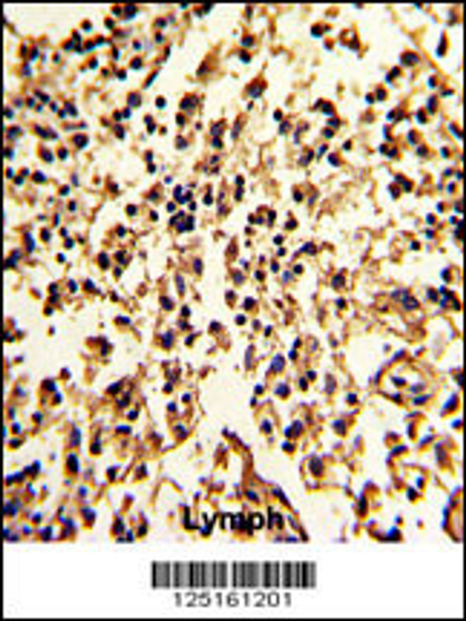 Formalin-fixed and paraffin-embedded human lymph with SERPINA9 Antibody, which was peroxidase-conjugated to the secondary antibody, followed by DAB staining.