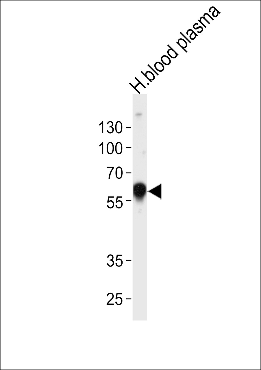 Western blot analysis of lysate from human blood plasma tissue lysate, using SERPINA1 Antibody at 1:1000 at each lane.