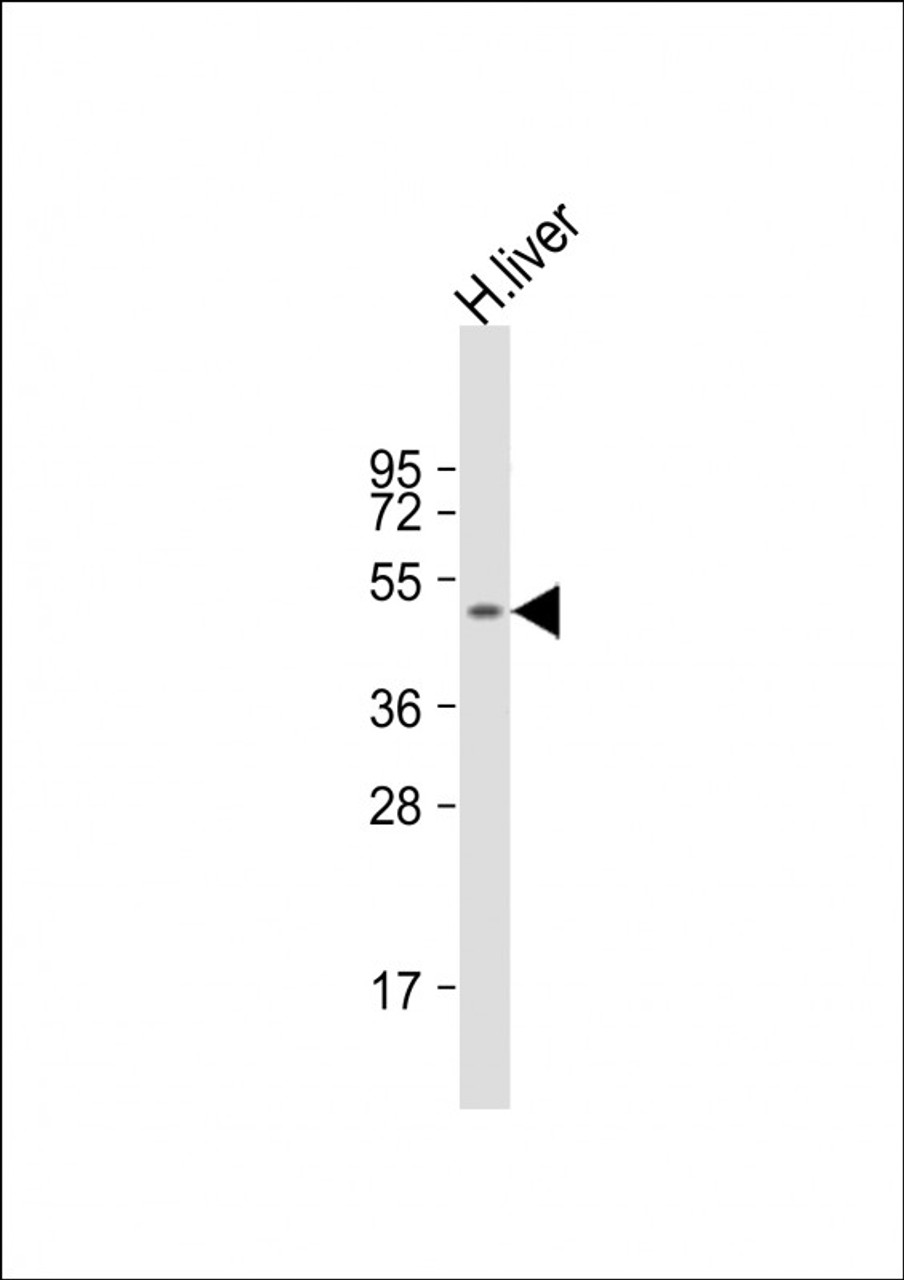 Western Blot at 1:1000 dilution + human liver lysate Lysates/proteins at 20 ug per lane.