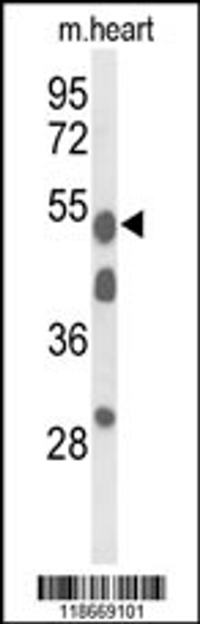 Western blot analysis of A1BG Antibody in mouse heart tissue lysates (35ug/lane)