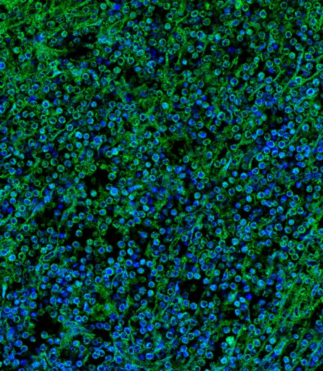 Immunofluorescent analysis of 4% paraformaldehyde-fixed, 0. 1% Triton X-100 permeabilized human spleen tissue labeling Pdx1 with AP9450a at 1/25 dilution, followed by Alexa Fluor 488-conjugated goat anti-rabbit IgG (1583138) secondary antibody at 1/400 dilution (green) . Confocal image showing membrane staining on human spleen tissue. The nuclear counter stain is DAPI (blue) .