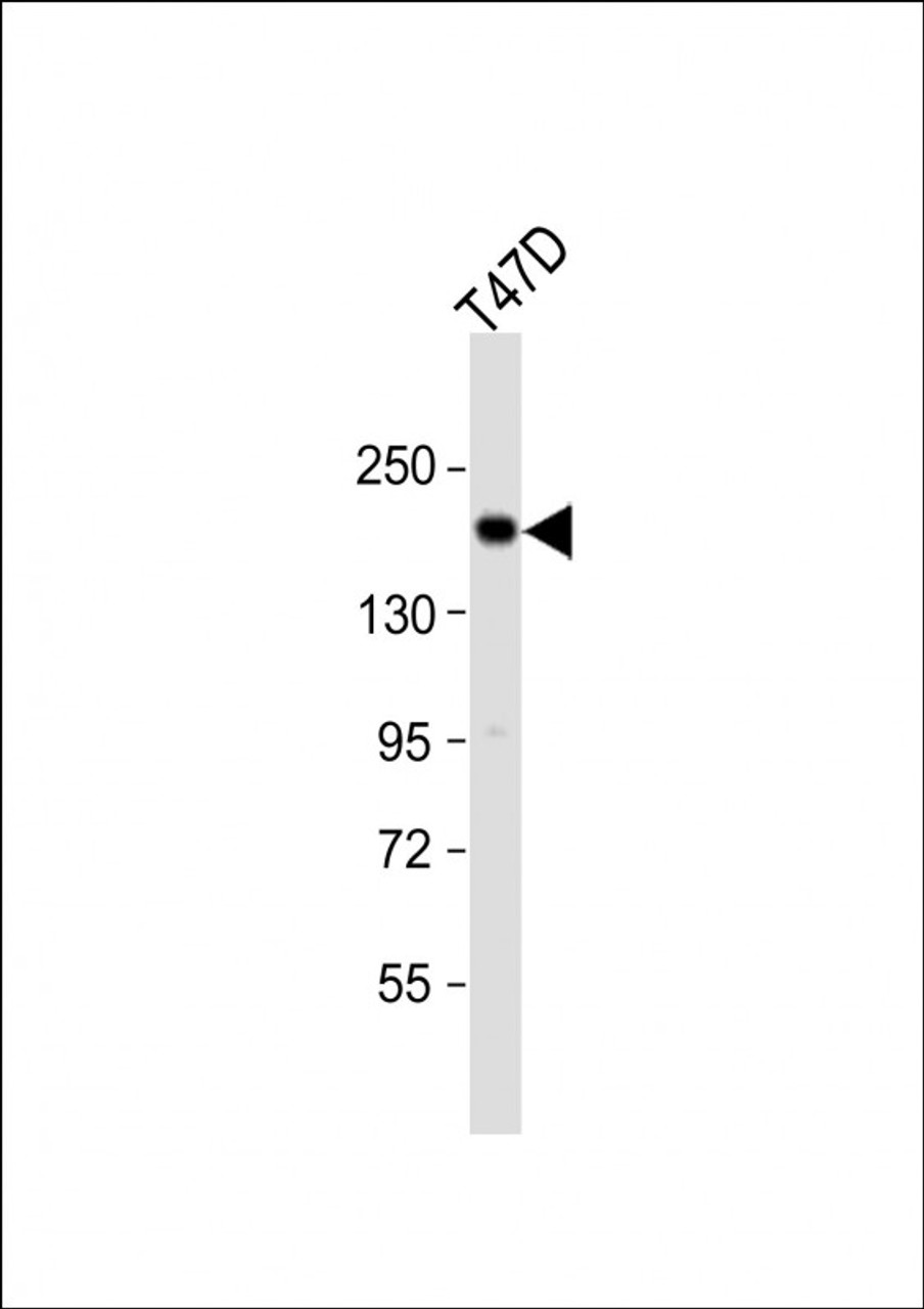 Western Blot at 1:1000 dilution + T47D whole cell lysate Lysates/proteins at 20 ug per lane.