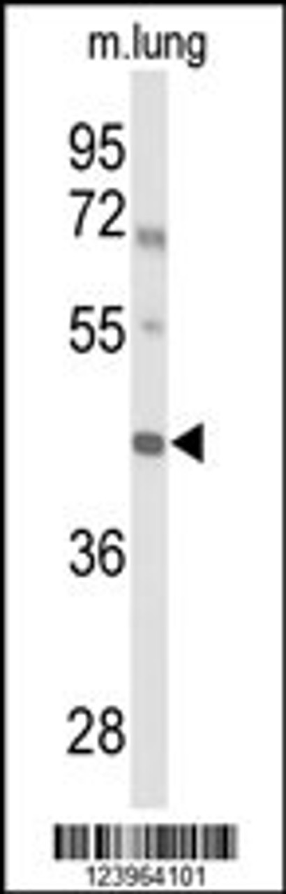 Western blot analysis of IRX2 Antibody in mouse lung tissue lysates (35ug/lane)