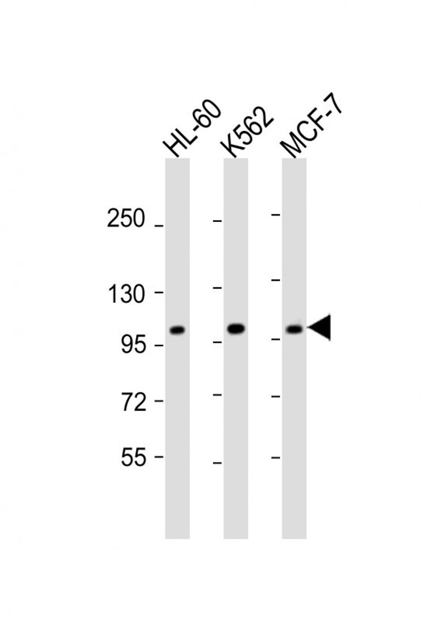 Western Blot at 1:2000 dilution Lane 1: HL-60 whole cell lysate Lane 2: K562 whole cell lysate Lane 3: MCF-7 whole cell lysate Lysates/proteins at 20 ug per lane.