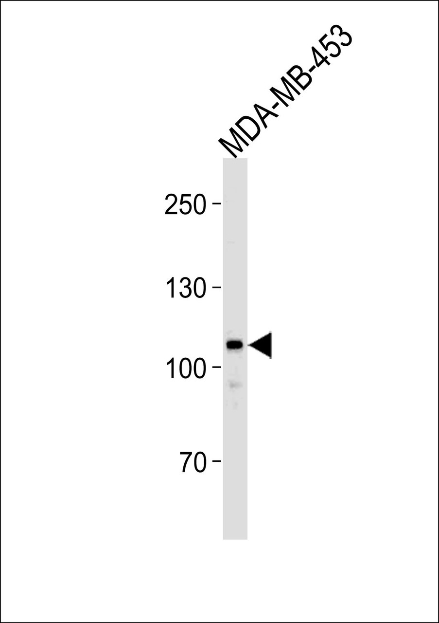 Western blot analysis of lysate from MDA-MB-453 cell line, using GEN1 Antibody at 1:1000.
