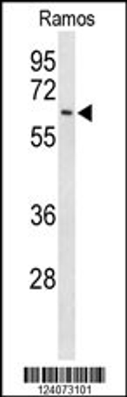 Western blot analysis of EIF2A Antibody in Ramos cell line lysates (35ug/lane)