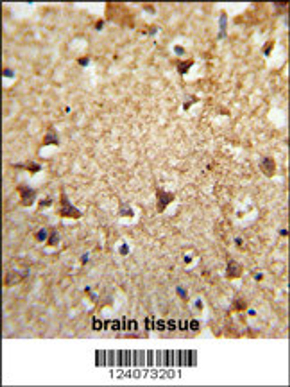 Formalin-fixed and paraffin-embedded human brain tissue reacted with EIF2A Antibody, which was peroxidase-conjugated to the secondary antibody, followed by DAB staining.