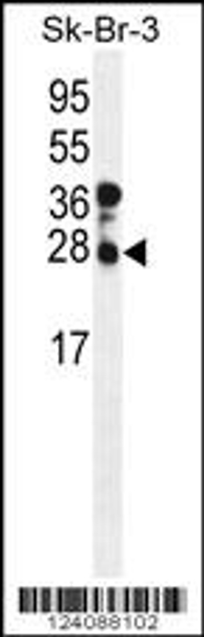 Western blot analysis of CHMP4B Antibody in SK-BR-3 cell line lysates (35ug/lane)