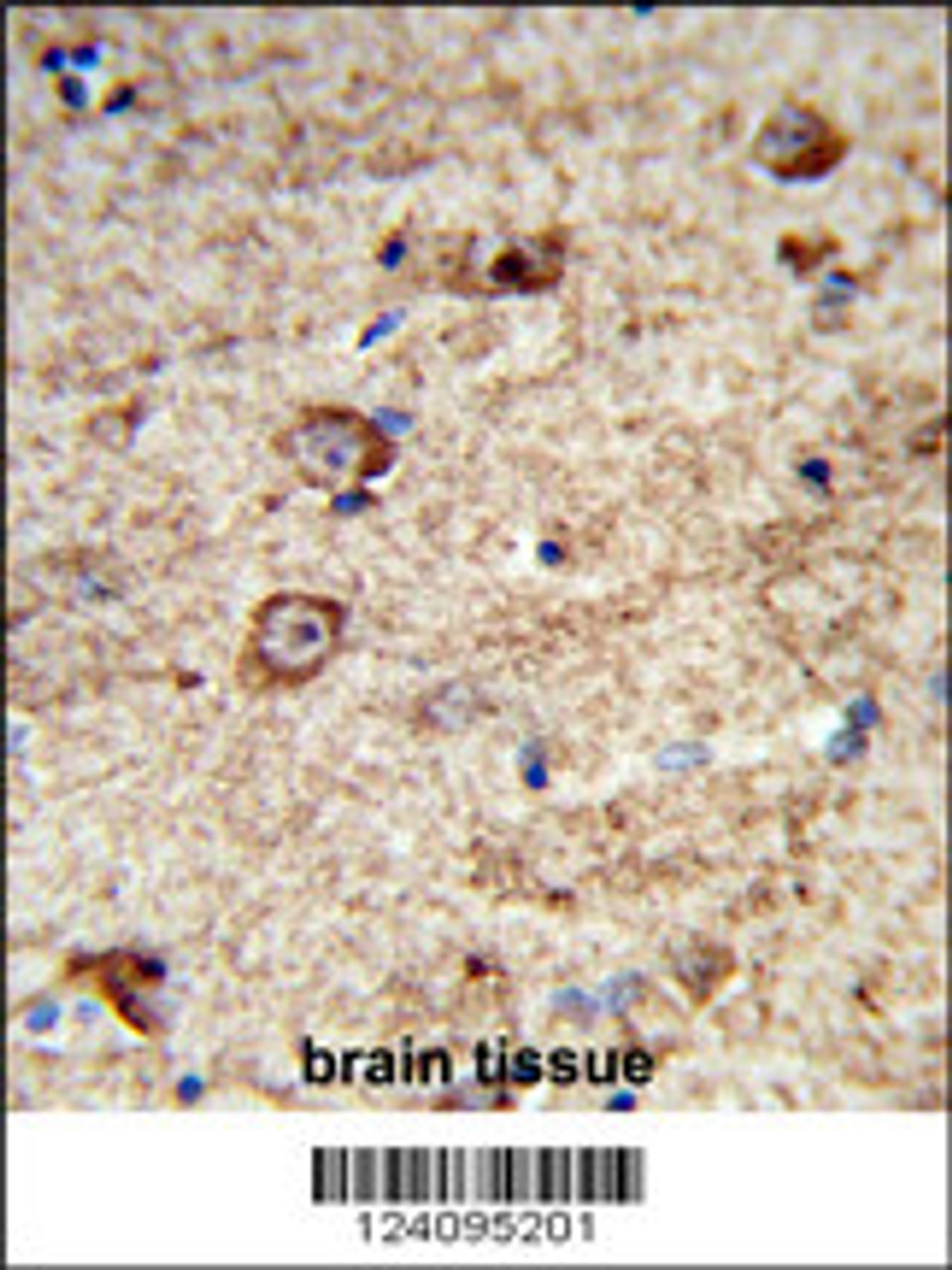 Formalin-fixed and paraffin-embedded human brain tissue reacted with LRRC4 Antibody, which was peroxidase-conjugated to the secondary antibody, followed by DAB staining.