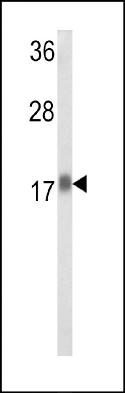 Western blot analysis of RPL31 Antibody in Hela cell line lysates (35ug/lane)