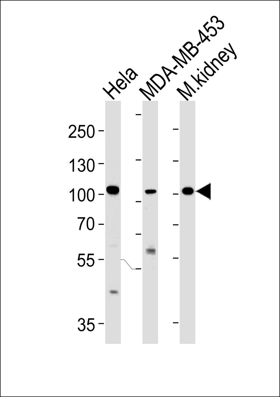 Western blot analysis in Hela, MDA-MB-453 cell line and mouse kidney tissue lysates (35ug/lane) .