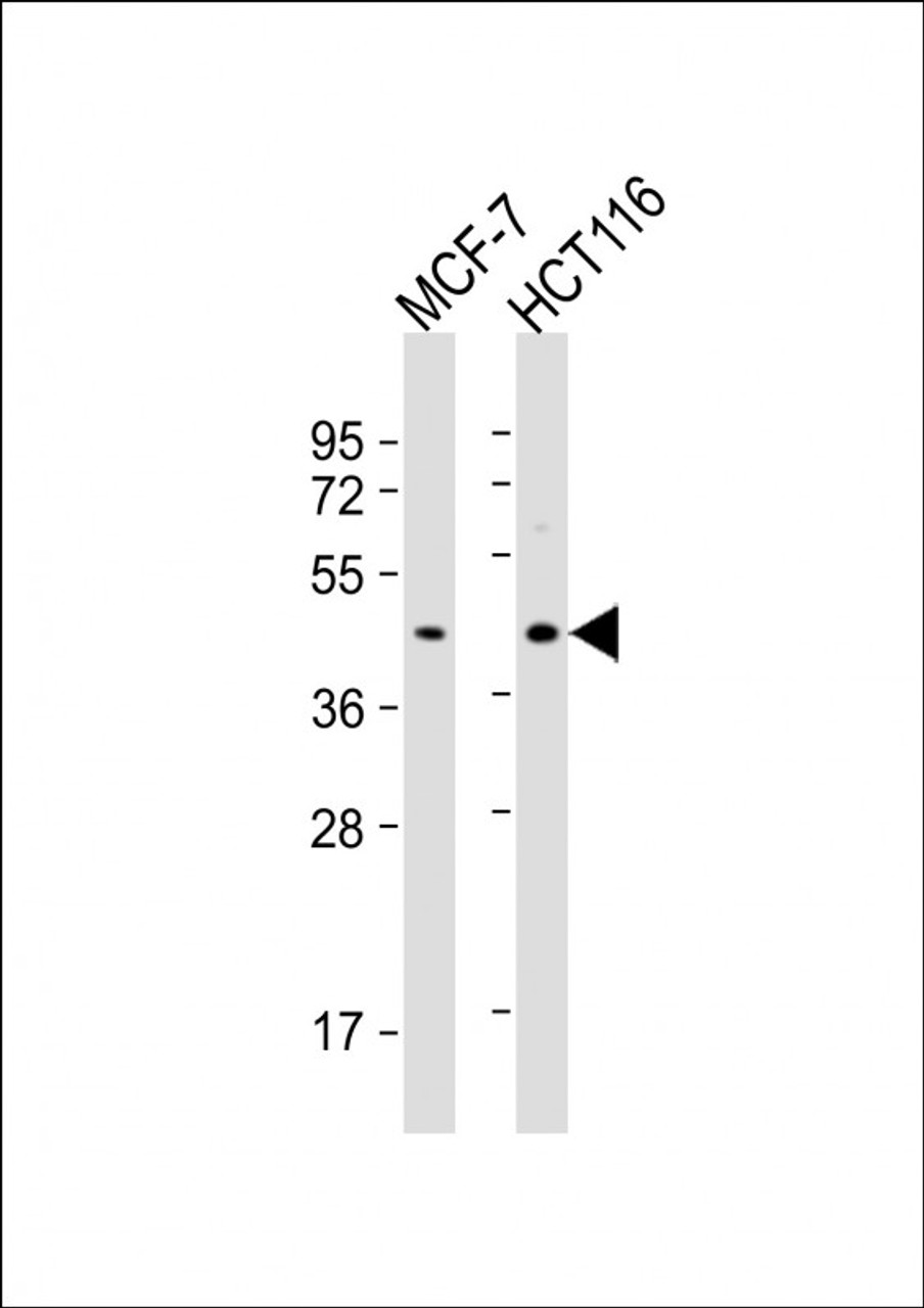 Western Blot at 1:1000 dilution Lane 1: MCF-7 whole cell lysate Lane 2: HCT116 whole cell lysate Lysates/proteins at 20 ug per lane.