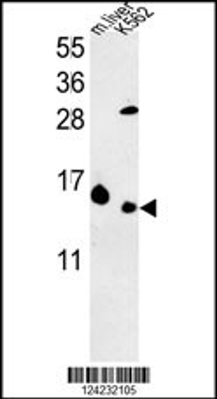 Western blot analysis in K562 cell line and mouse liver tissue lysates (35ug/lane) .