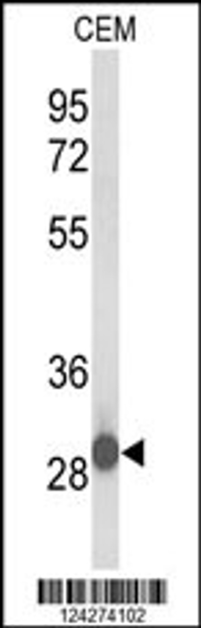 Western blot analysis of C15orf29 Antibody in CEM cell line lysates (35ug/lane)