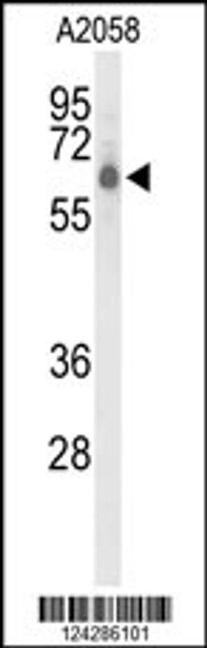 Western blot analysis of CLPTM1L Antibody in A2058 cell line lysates (35ug/lane)