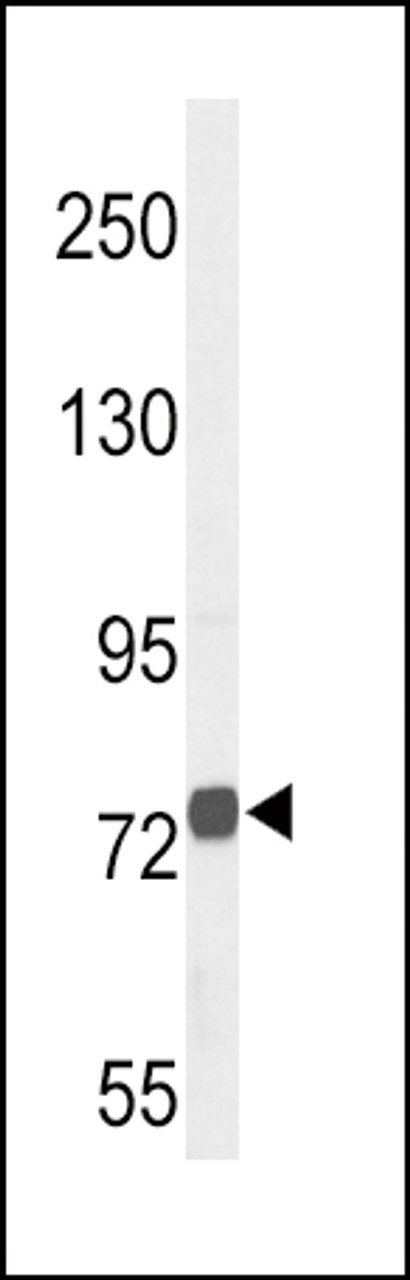 Western blot analysis of CHAT Antibody in NCI-H460 cell line lysates (35ug/lane)