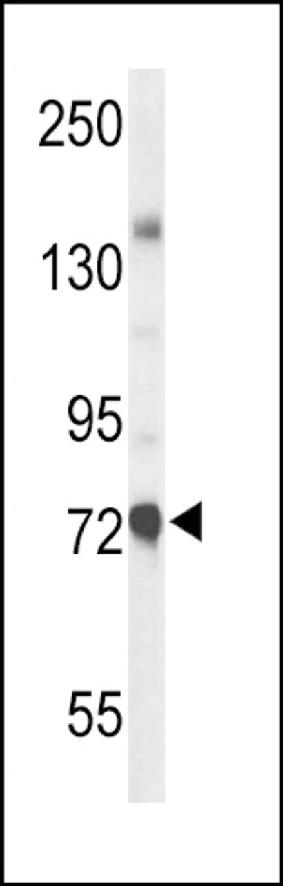 Western blot analysis of CHAT Antibody in mouse liver tissue lysates (35ug/lane)