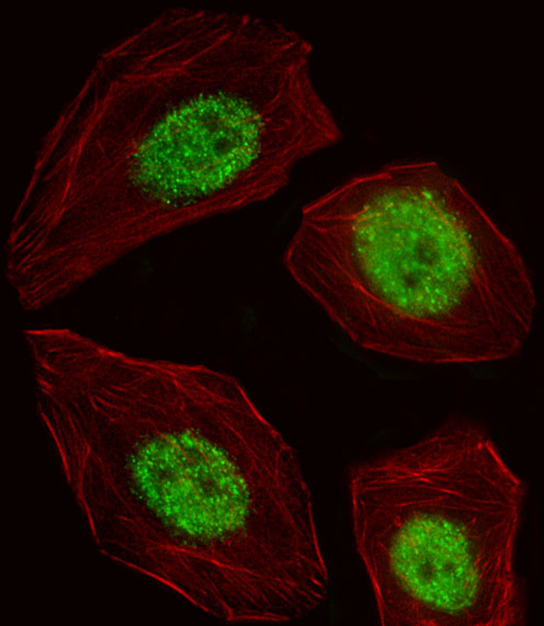 Fluorescent image of A549 cell stained with BLZF1 Antibody .A549 cells were fixed with 4% PFA (20 min) , permeabilized with Triton X-100 (0.1%, 10 min) , then incubated with BLZF1 primary antibody (1:25) . For secondary antibody, Alexa Fluor 488 conjugated donkey anti-rabbit antibody (green) was used (1:400) .Cytoplasmic actin was counterstained with Alexa Fluor 555 (red) conjugated Phalloidin (7units/ml) .BLZF1 immunoreactivity is localized to Nucleus significantly.