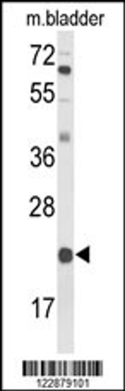 Western blot analysis of DGCR6 Antibody in mouse bladder tissue lysates (35ug/lane)