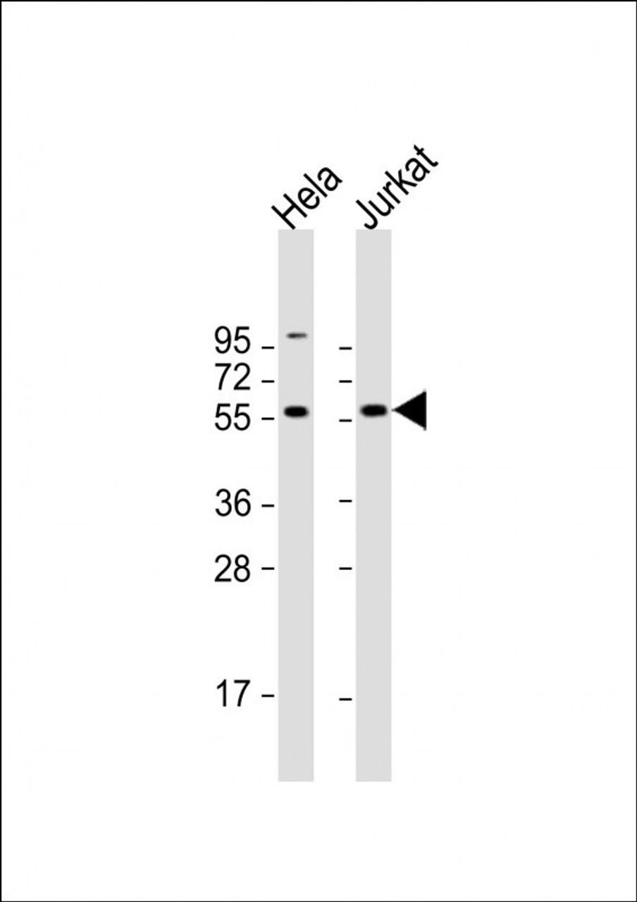 Western Blot at 1:2000 dilution Lane 1: Hela whole cell lysate Lane 2: Jurkat whole cell lysate Lysates/proteins at 20 ug per lane.