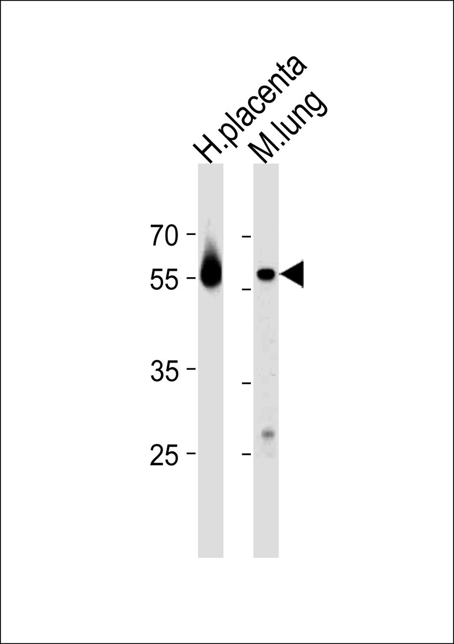 Western blot analysis in human placenta and mouse lung tissue lysates (35ug/lane) .