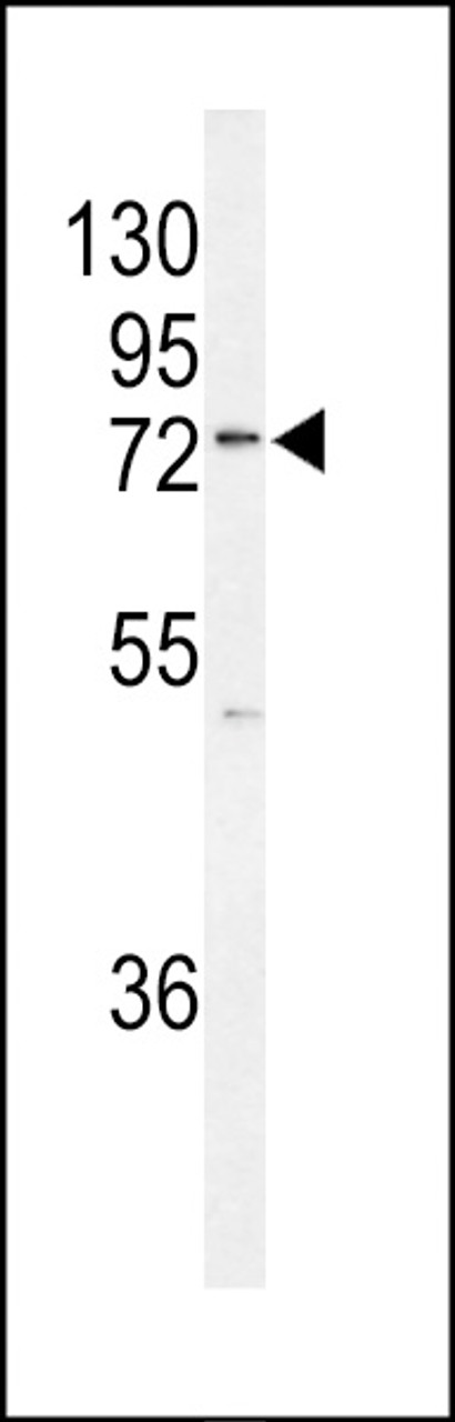 Western blot analysis of K0776 Antibody in MCF-7 cell line lysates (35ug/lane)