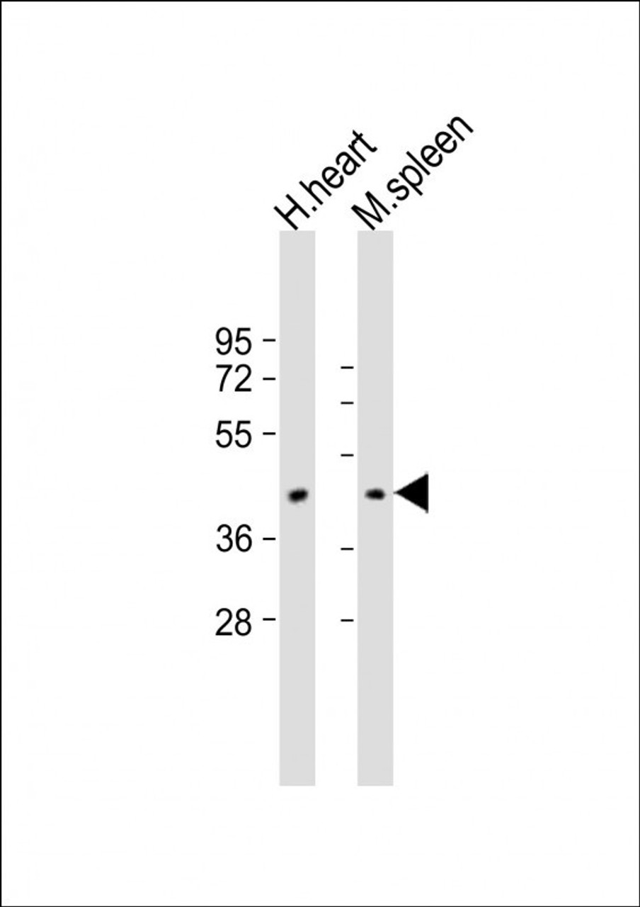 Western Blot at 1:2000 dilution Lane 1: human heart lysate Lane 2: mouse spleen lysate Lysates/proteins at 20 ug per lane.