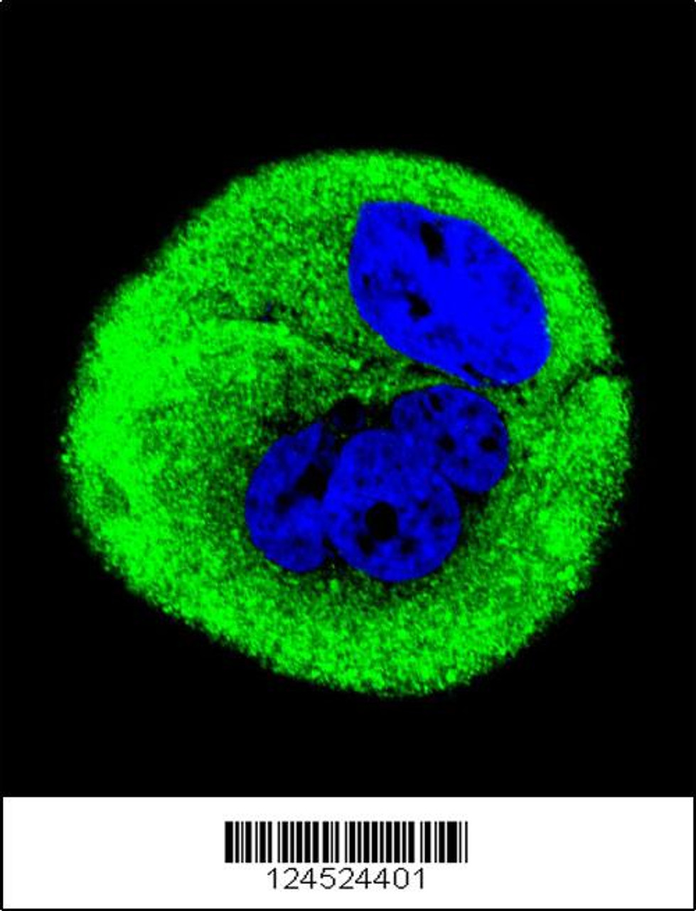 Confocal immunofluorescent analysis of COXI Antibody with MCF-7 cell followed by Alexa Fluor 488-conjugated goat anti-rabbit lgG (green) . DAPI was used to stain the cell nuclear (blue) .
