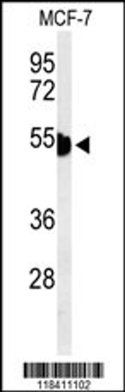 Western blot analysis of KRT1 Antibody in MCF-7 cell line lysates (35ug/lane)