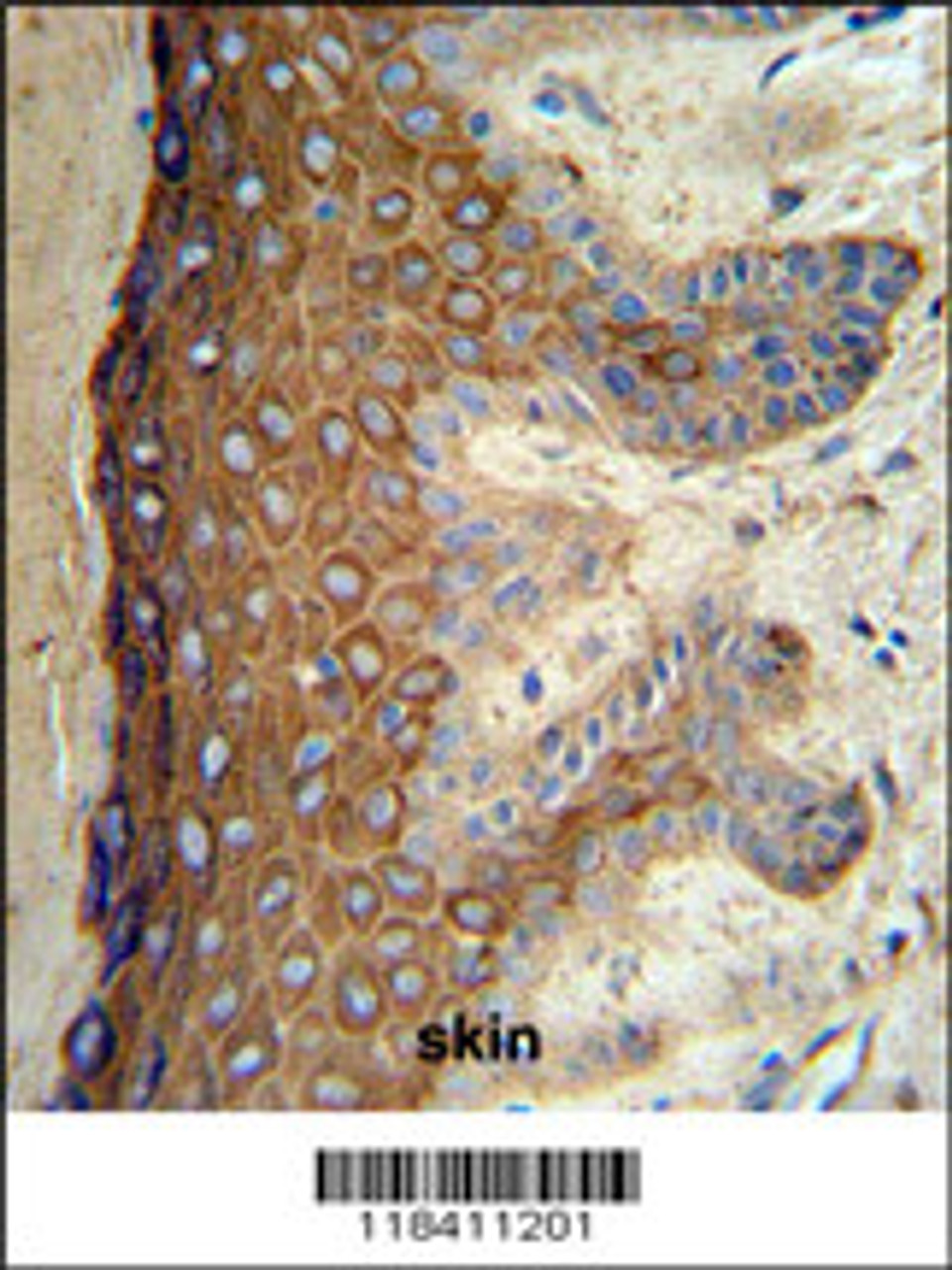 KRT1 Antibody IHC analysis in formalin fixed and paraffin embedded skin tissue followed by peroxidase conjugation of the secondary antibody and DAB staining.