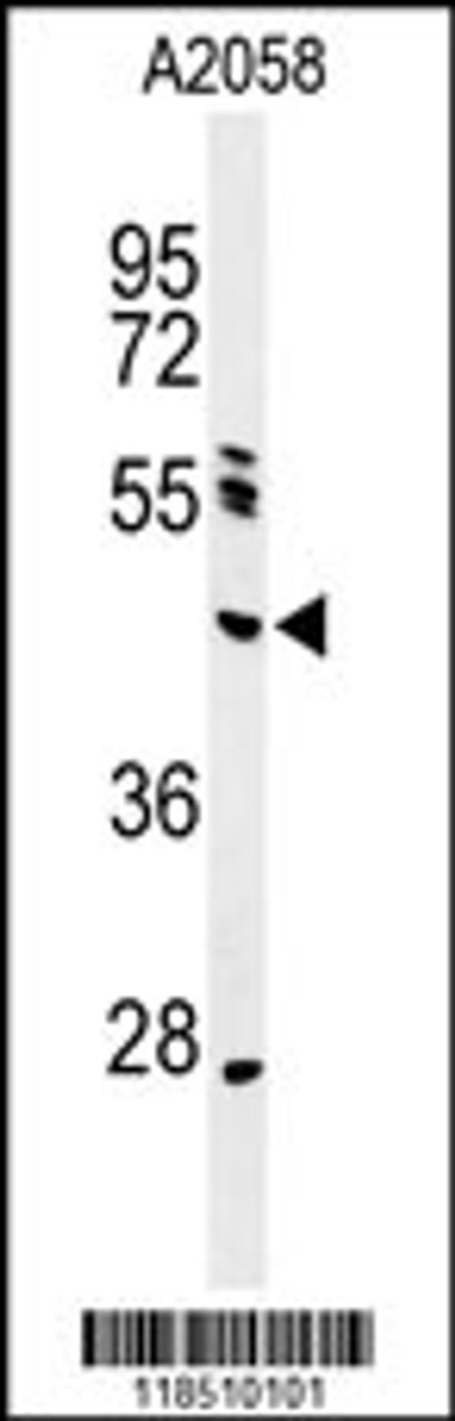 Western blot analysis of NEIL1 Antibody in A2058 cell line lysates (35ug/lane)