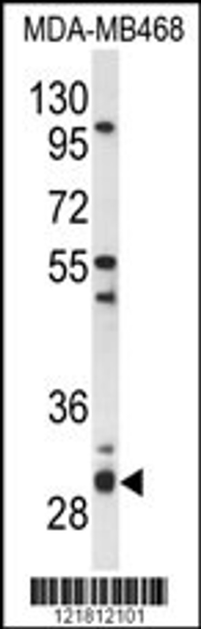 Western blot analysis of PSMG2 Antibody in MDA-MB468 cell line lysates (35ug/lane)