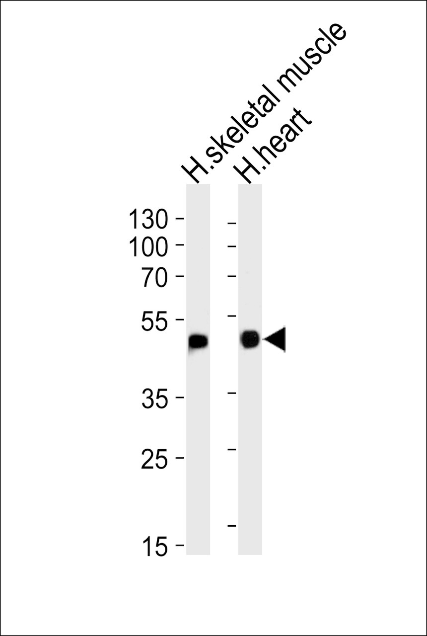 Western blot analysis of lysates from human skeletal muscle and heart tissue lysates (from left to right) , using HFE2 Antibody at 1:1000 at each lane.