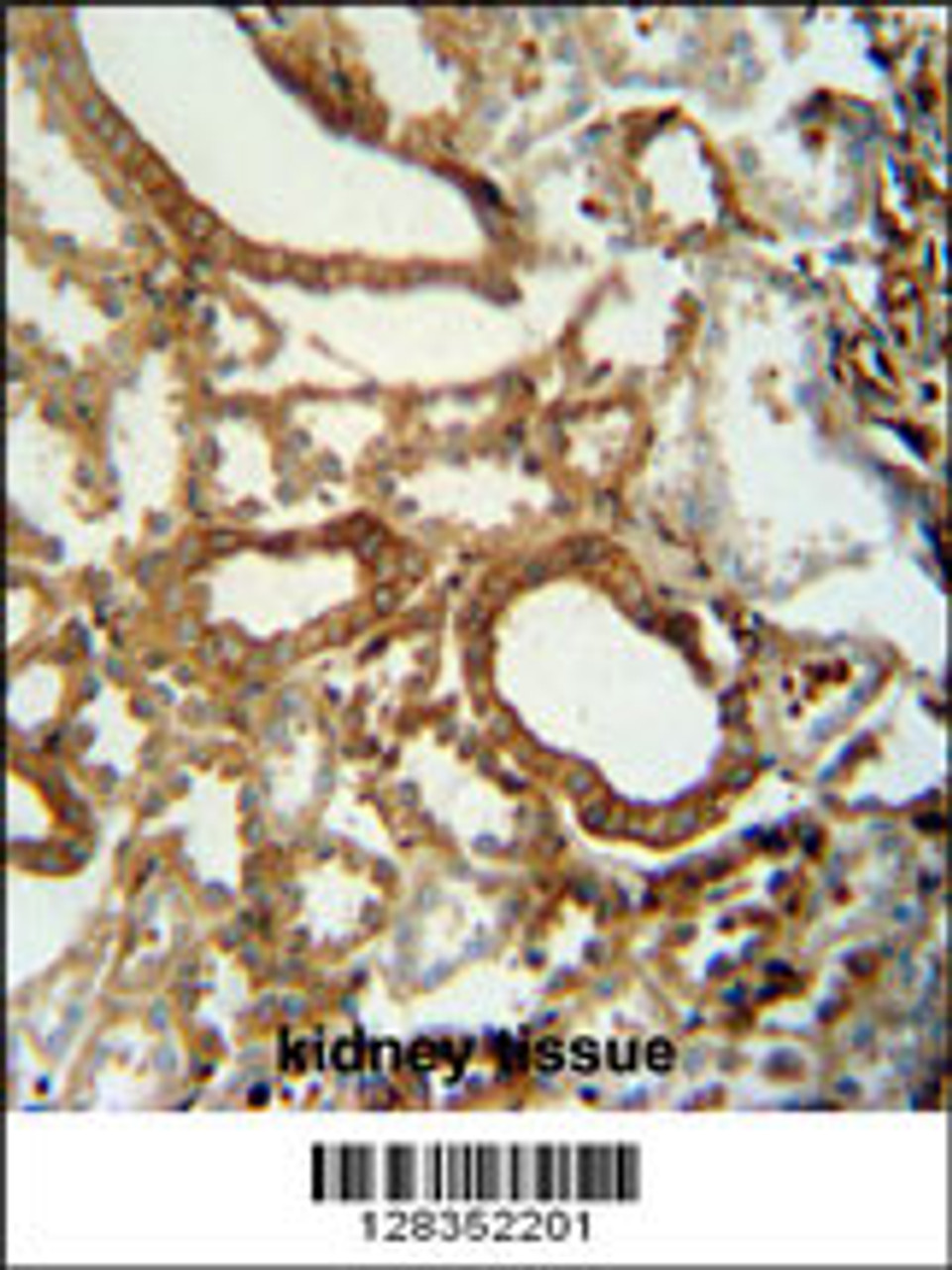 INSC antibody immunohistochemistry analysis in formalin fixed and paraffin embedded human kidney tissue followed by peroxidase conjugation of the secondary antibody and DAB staining.