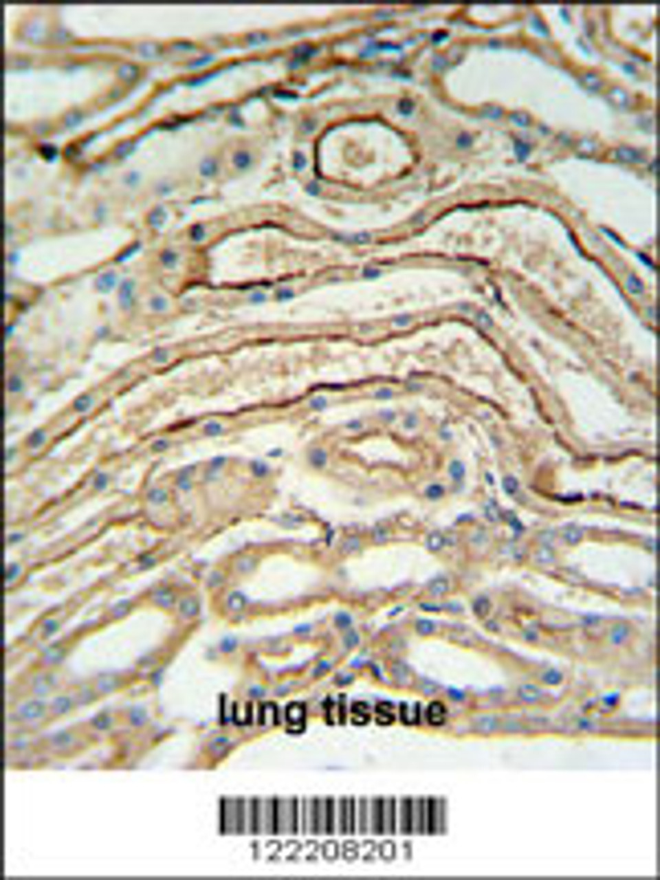 ADH7 Antibody IHC analysis in formalin fixed and paraffin embedded lung tissue followed by peroxidase conjugation of the secondary antibody and DAB staining.