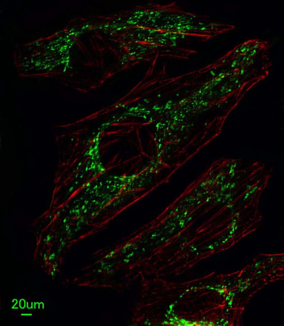 Immunofluorescent analysis of Hela cells, using SLC25A37 Antibody . Antibody was diluted at 1:25 dilution. Alexa Fluor 488-conjugated goat anti-rabbit lgG at 1:400 dilution was used as the secondary antibody (green) . Cytoplasmic actin was counterstained with Dylight Fluor 554 (red) conjugated Phalloidin (red) .