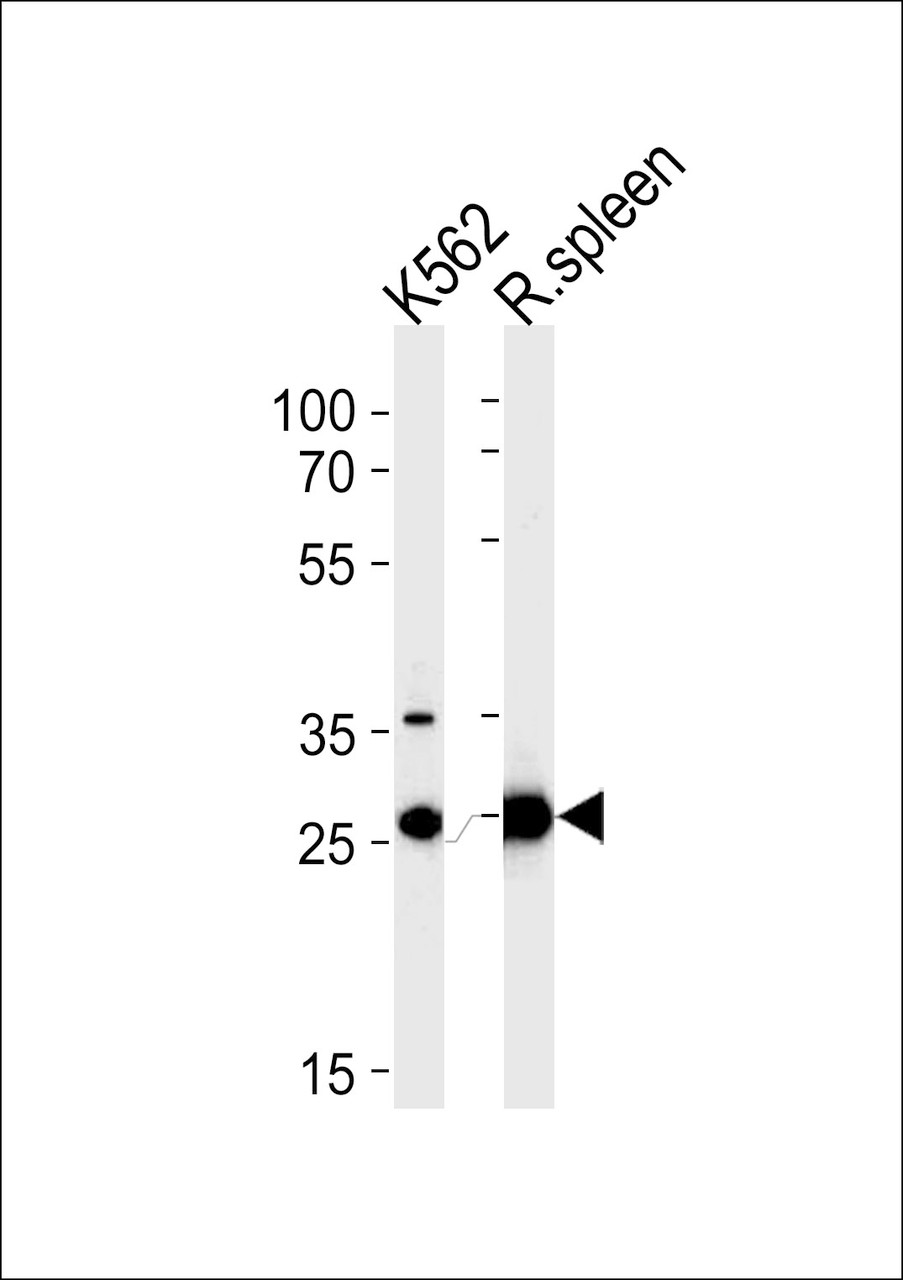 Western blot analysis in K562 cell line and rat spleen tissue lysates (35ug/lane) .