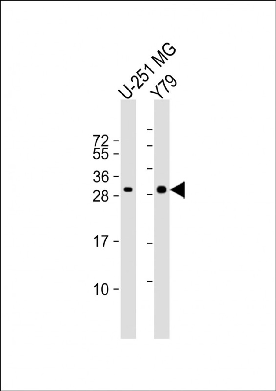 Western Blot at 1:1000 dilution Lane 1: U-251 MG whole cell lysate Lane 2: Y79 whole cell lysate Lysates/proteins at 20 ug per lane.