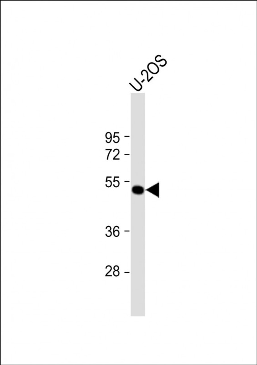 Western Blot at 1:1000 dilution + U-2OS whole cell lysate Lysates/proteins at 20 ug per lane.