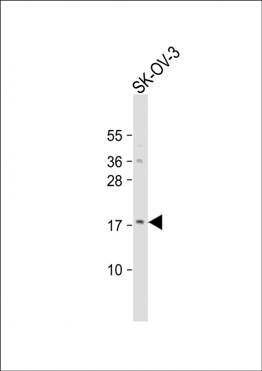 Western Blot at 1:1000 dilution + SK-OV-3 whole cell lysate Lysates/proteins at 20 ug per lane.