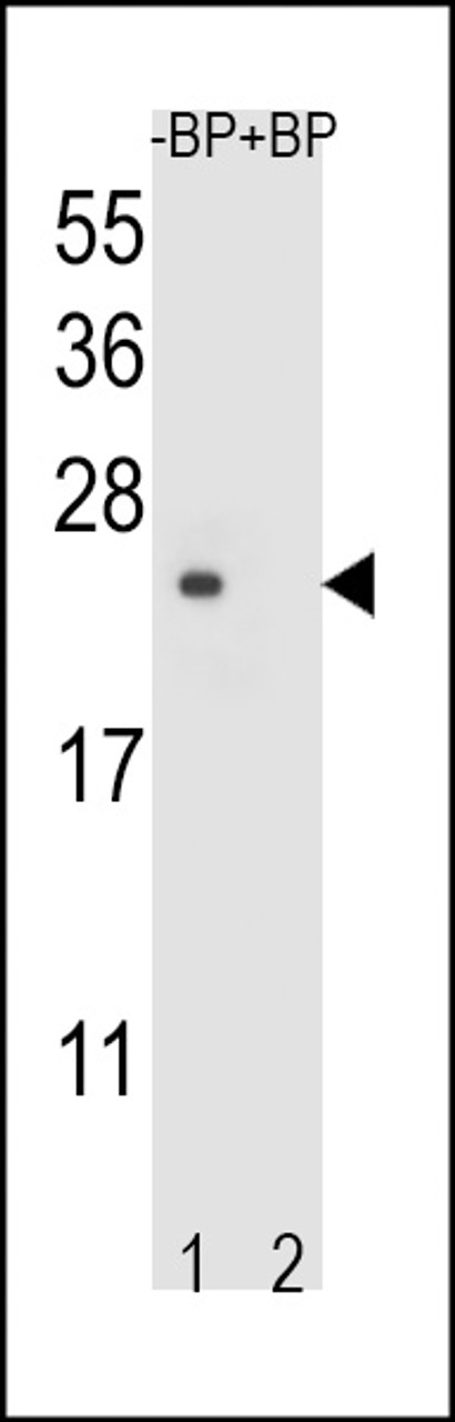 Western blot analysis of T4S4 Antibody Pab pre-incubated without (lane 1) and with (lane 2) blocking peptide in liver cell line lysate.