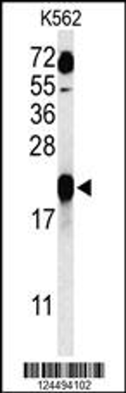 Western blot analysis of GAGE7 Antibody in K562 cell line lysates (35ug/lane)