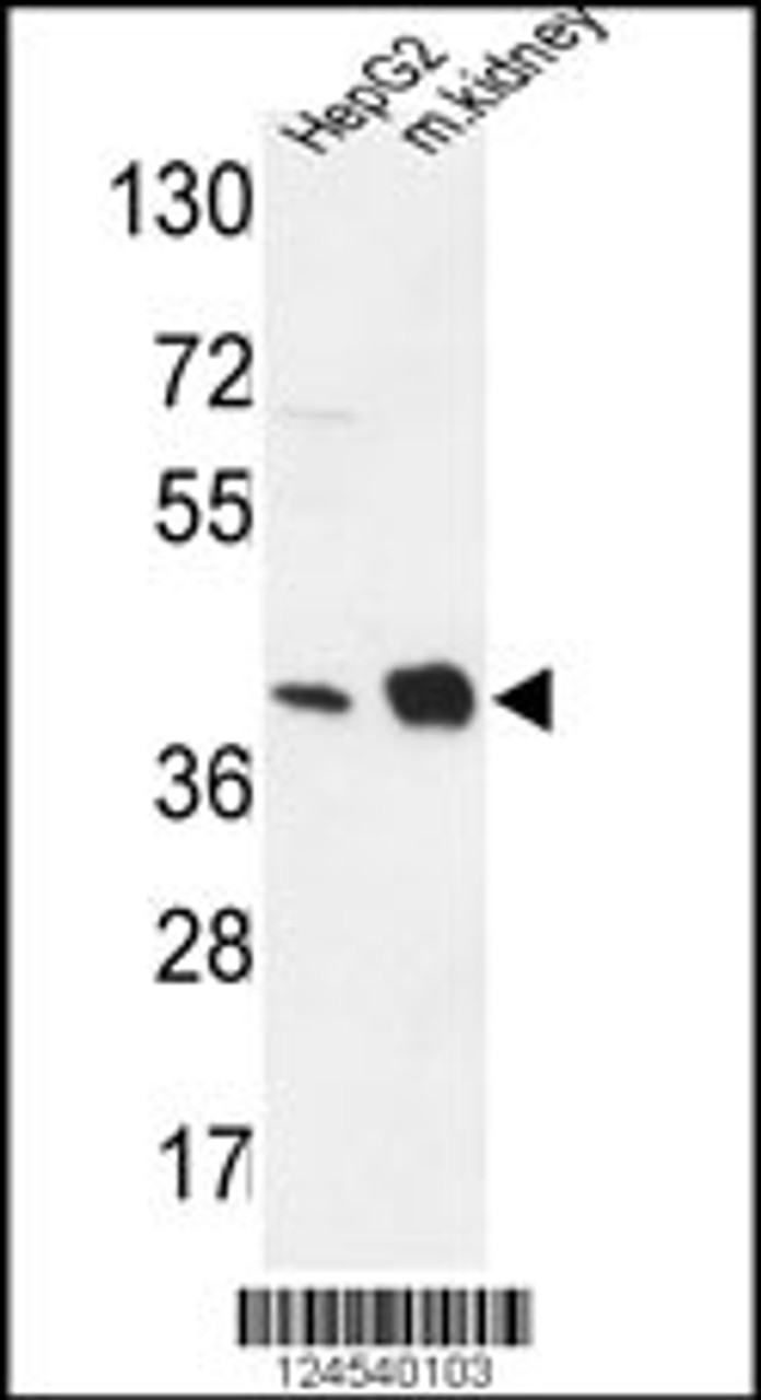 Western blot analysis in HepG2 cell line and mouse kidney tissue lysates (35ug/lane) .