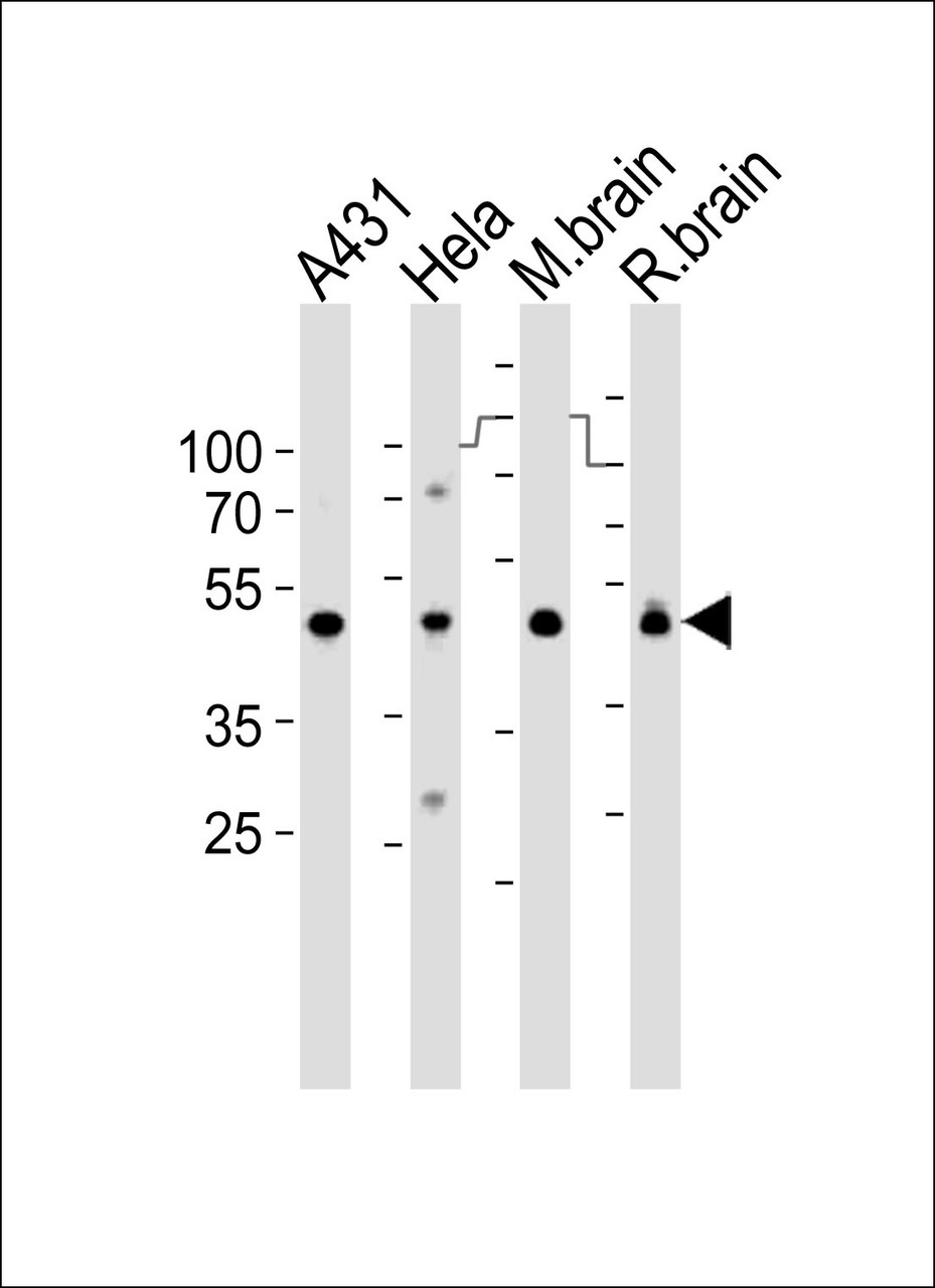 Western blot analysis of lysates from A431, Hela cell line, mouse brain and rat brain tissue lysate (from left to right) , using NDUFS2 Antibody at 1:1000 at each lane.