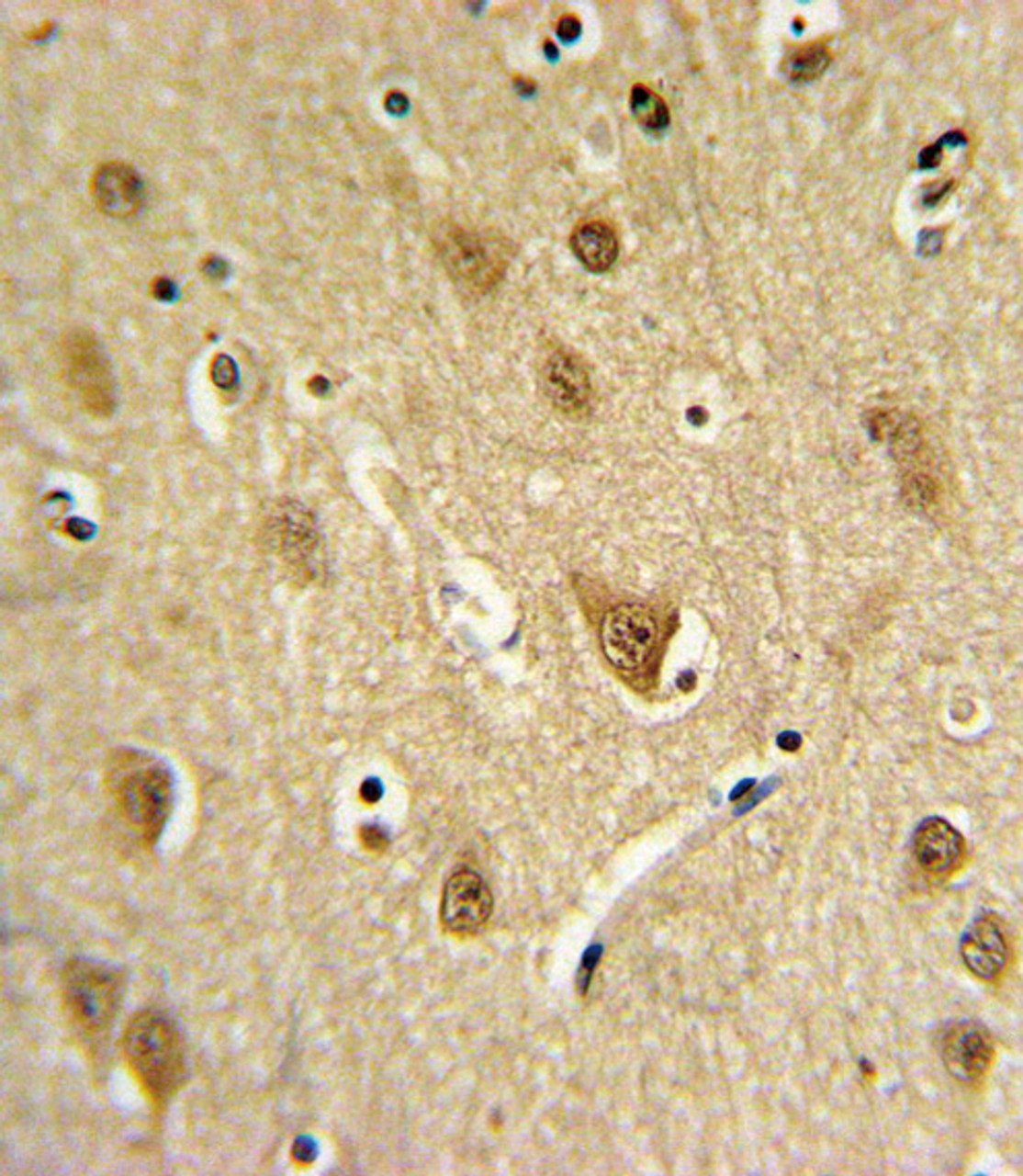 ST8SIA4 Antibody IHC analysis in formalin fixed and paraffin embedded brain tissue followed by peroxidase conjugation of the secondary antibody and DAB staining.