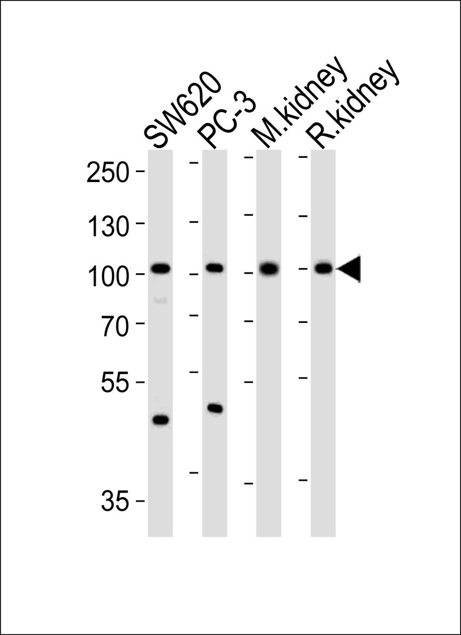 Western blot analysis of lysates from SW620, PC-3 cell line, mouse kidney, rat kidney tissue lysate (from left to right) , using SUPV3L1 Antibody at 1:1000 at each lane.