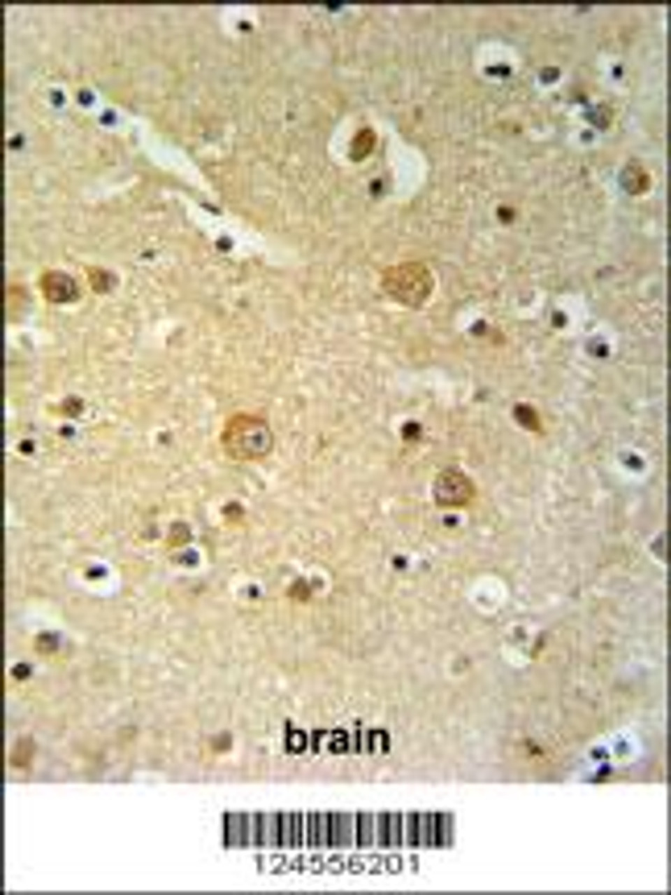 PKHH2 Antibody IHC analysis in formalin fixed and paraffin embedded brain tissue followed by peroxidase conjugation of the secondary antibody and DAB staining.