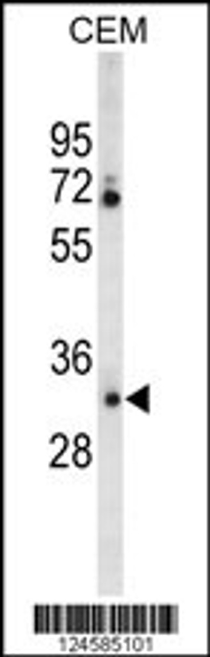 Western blot analysis of CA6 Antibody in CEM cell line lysates (35ug/lane)