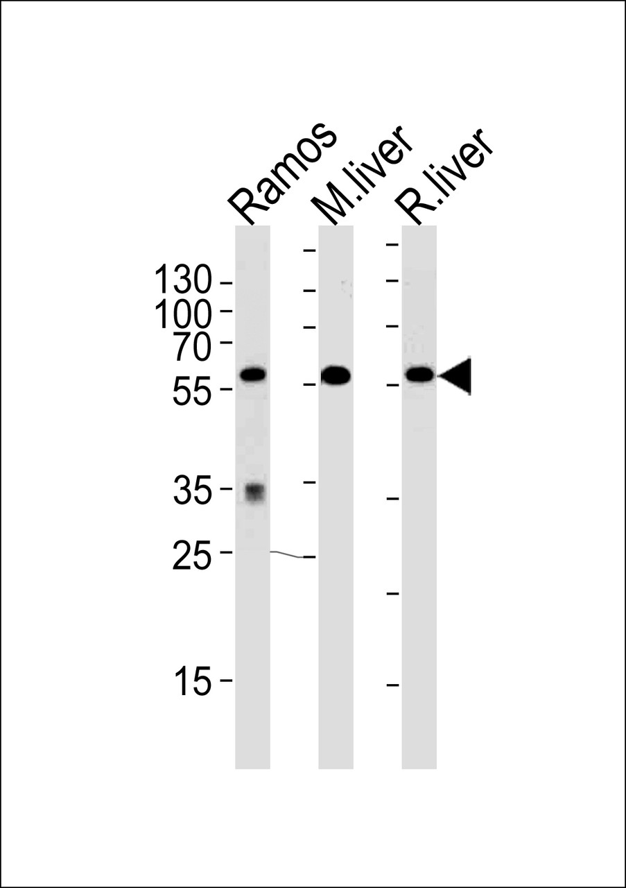 Western blot analysis of lysates from Ramos cell line, mouse liver, rat liver tissue (from left to right) , using GPI Antibody .AP9786b was diluted at 1:1000 at each lane.