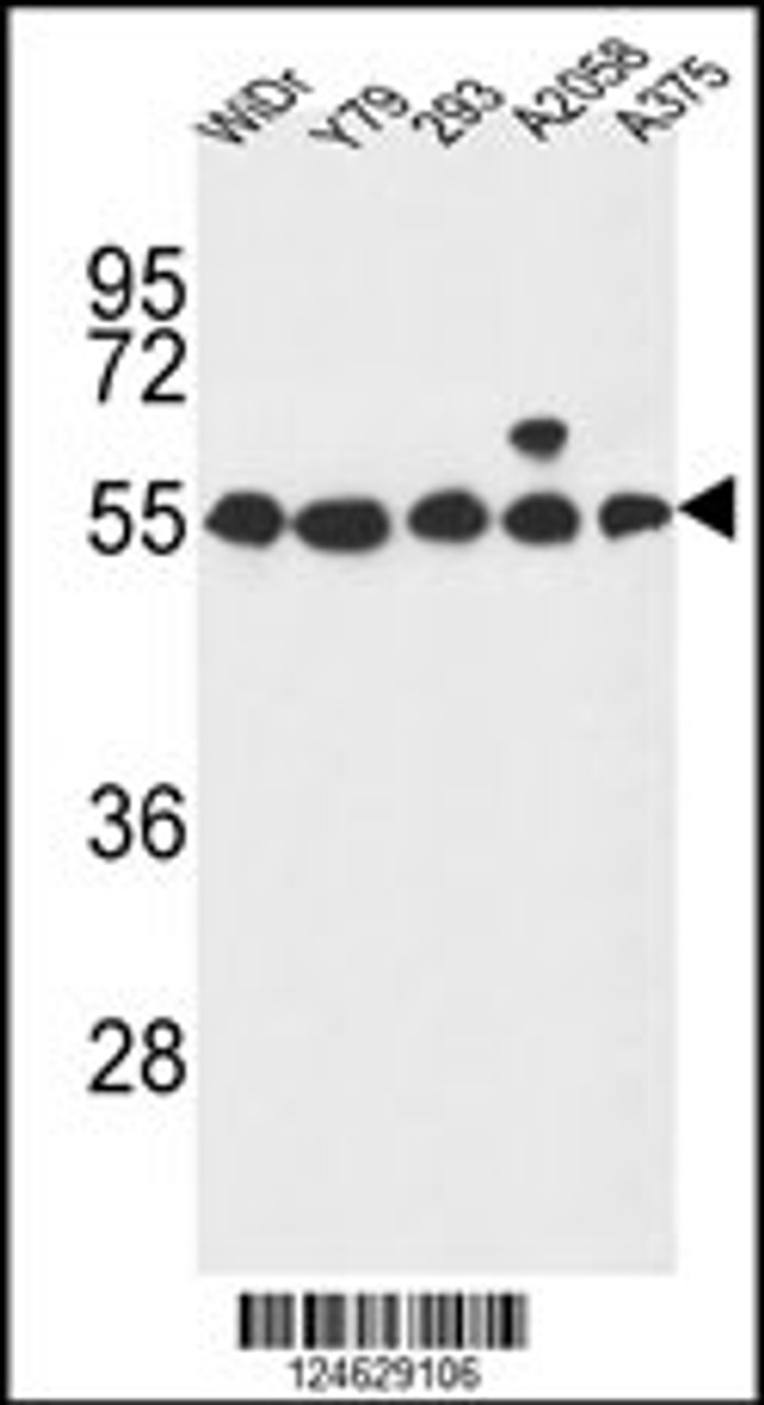 Western blot analysis in WiDr, Y79, 293, A2058, A375 cell line lysates (35ug/lane) .